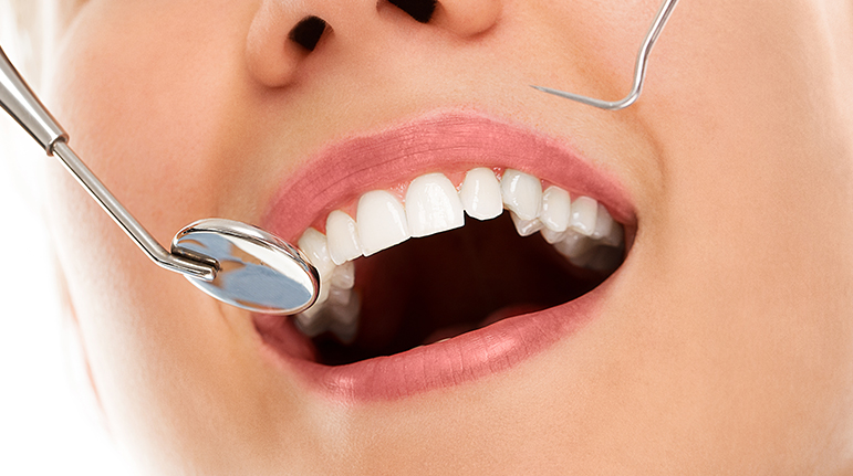 Composite bonding treatment