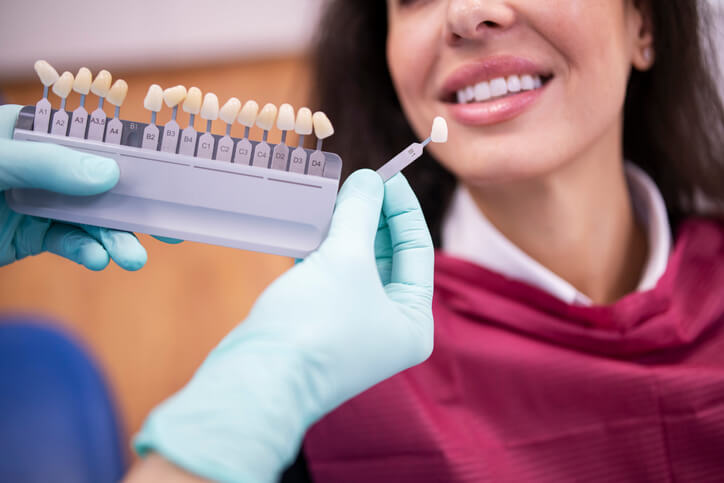 Porcelain Veneers