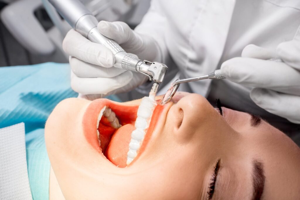 Teeth Cleaning