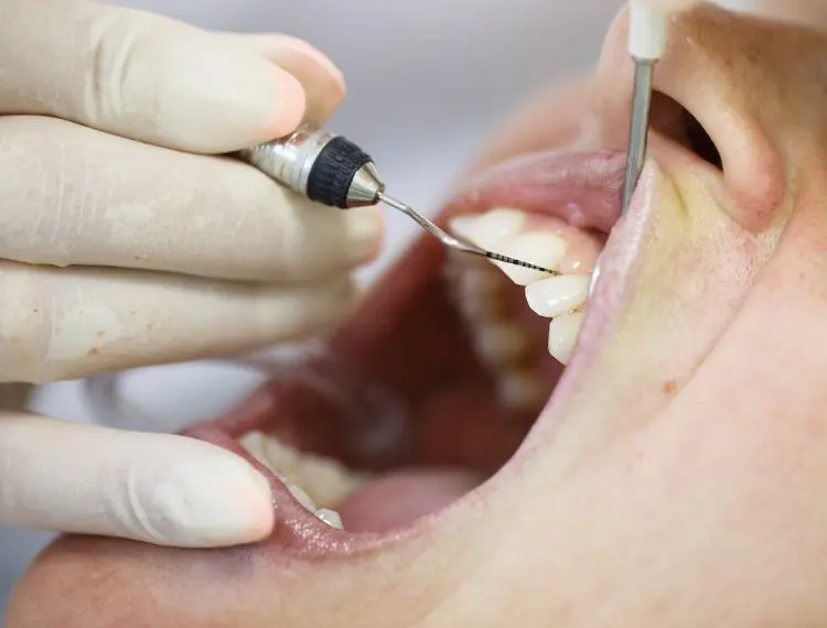 gum-disease treatment