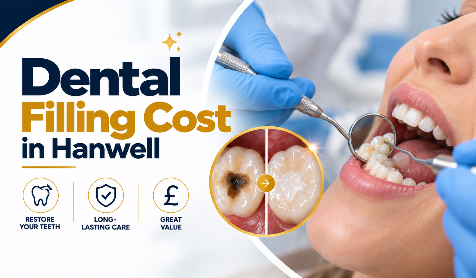 Dental Filling Cost In Hanwell